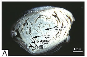 図２：ラット雄に誘発した膀胱結石の断面図
