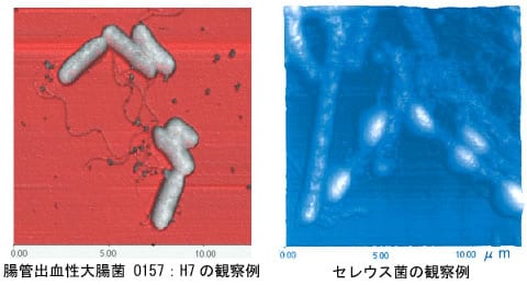 O157の顕微鏡観察