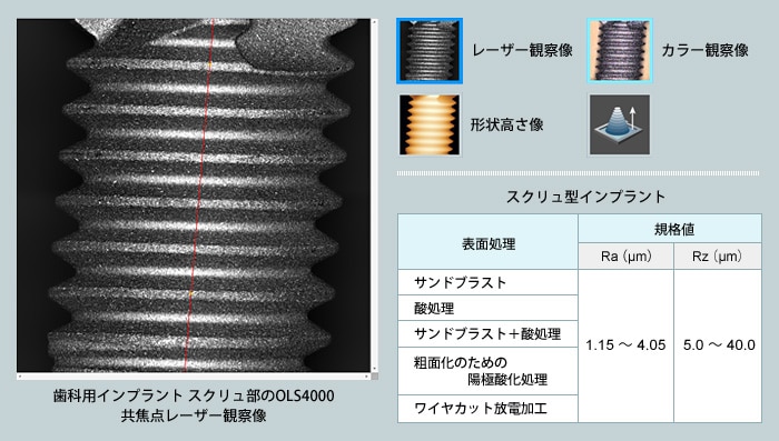 歯科用インプラント　スクリュ部のOLS4000　共焦点レーザー観察像