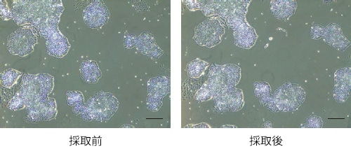 採取前後の様子