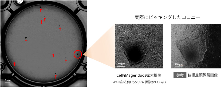 コロニー形成での活用