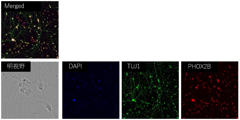 iPS細胞由来交感神経 多重免疫染色