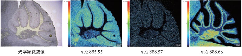 5 umの空間解像度による小脳の測定結果
