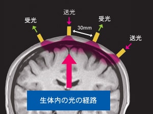 fNIRS計測原理：生体内の光の経路