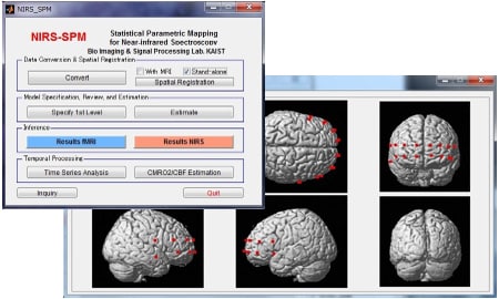 NIRS-SPM