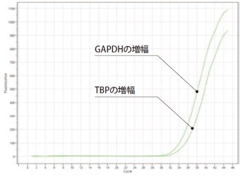 日和見感染症ウイルス検出キット 株式会社島津製作所