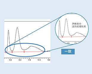 誰でも熟練者の波形処理を実現