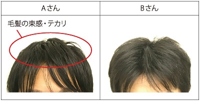図1　AさんとBさんの毛髪の写真
