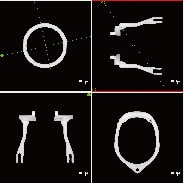 MPR画像 FOV=φ207.6mm