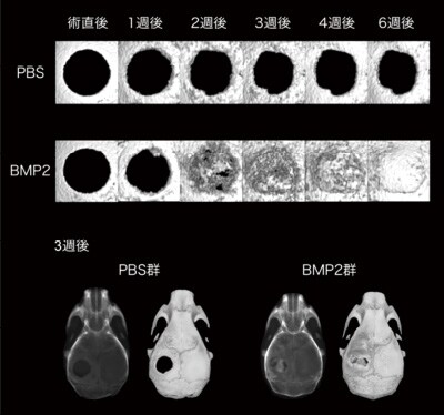 マウス頭蓋冠に作成した骨欠損の経時変化の観察例
