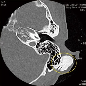 参考:医用CT による摘出前の断面画像