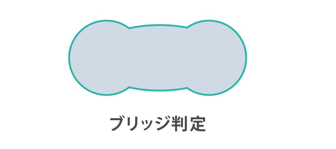 はんだバンプのショート