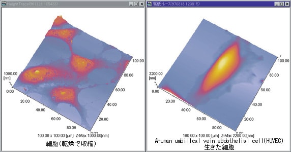 臍静脈内皮細胞(HUVEC)観察例